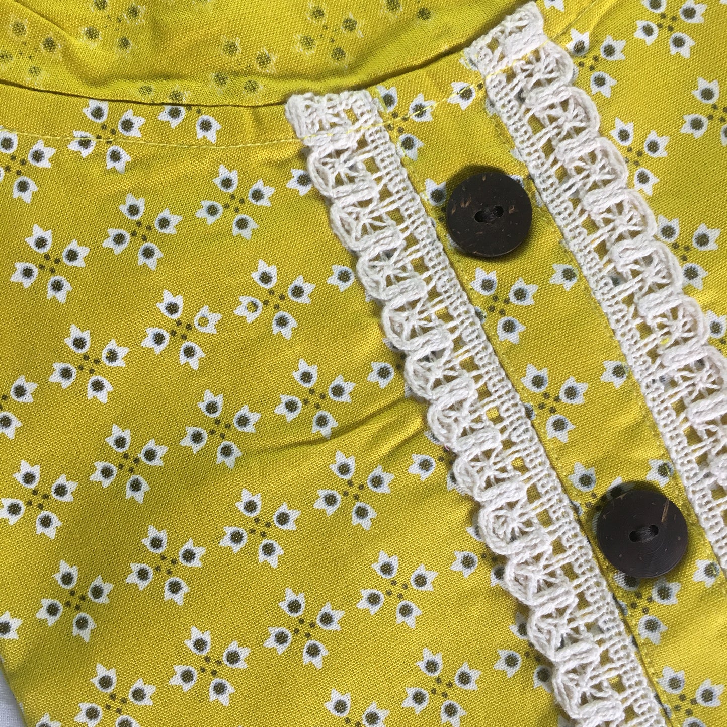 Yellow Lace work Cotton Kurti- Knee Length - 3871